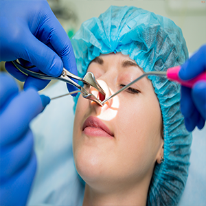 Nose Surgeries